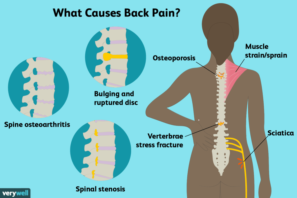 nugaros skausmas